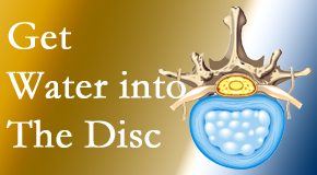 Apple Country Chiropractic uses spinal manipulation and exercise to boost the diffusion of water into the disc which supports the health of the disc.