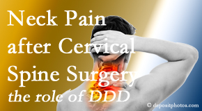 Apple Country Chiropractic offers gentle care for neck pain after neck surgery.