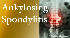Ankylosing spondylitis is gently cared for by your Williamson chiropractor.