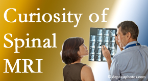 Williamson MRIs for spinal stenosis may be revealing…or puzzling.