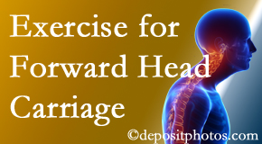 Williamson chiropractic treatment of forward head carriage is two-fold: manipulation and exercise.