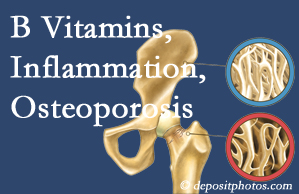 Williamson chiropractic care of osteoporosis usually comes with nutritional tips like b vitamins for inflammation reduction and for prevention.