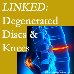 Degenerated discs and degenerated knees are not such unlikely companions. They are seen to be related. Williamson patients with a loss of disc height due to disc degeneration often also have knee pain related to degeneration.  