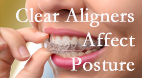 Clear aligners influence posture which Williamson chiropractic helps.