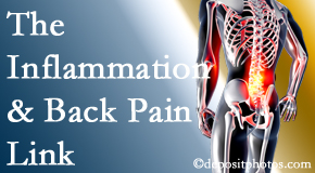 Apple Country Chiropractic tackles the inflammatory process that accompanies back pain as well as the pain itself.
