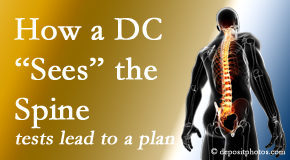 Apple Country Chiropractic will utilize any combination of a variety of means to see the spine and diagnose its underlying pain issue to set a course for pain relief.