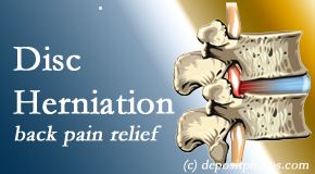 Apple Country Chiropractic uses non-surgical treatment for relief of disc herniation related back pain. 