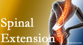 Apple Country Chiropractic knows the role of extension in spinal motion, its necessity, its benefits and potential harmful effects. 