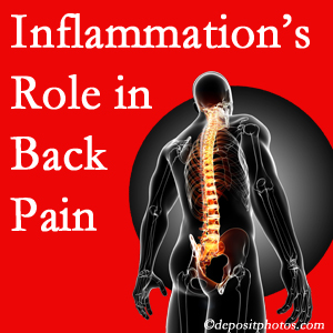 The role of inflammation in Williamson back pain is real. Chiropractic care can manage it.