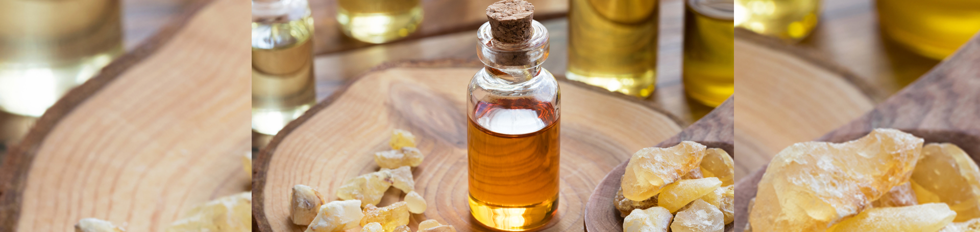 Williamson anti-inflammatory frankincense