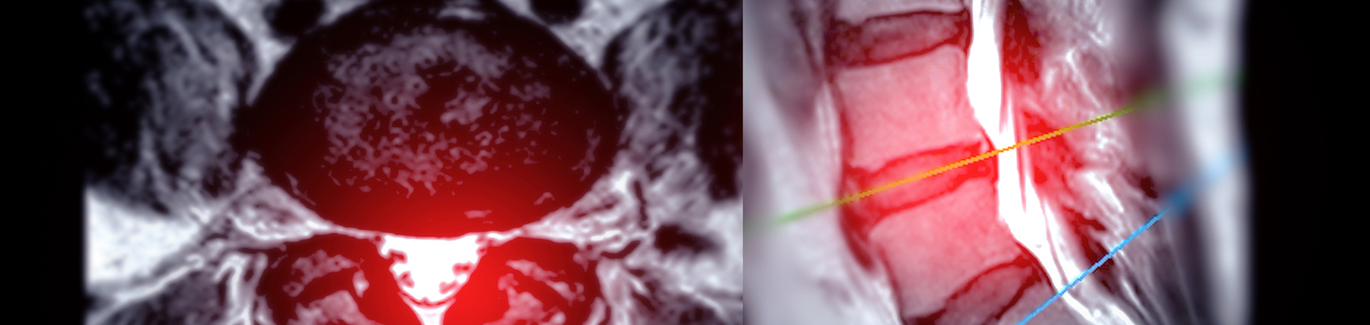 Williamson back pain imaging and exercise