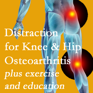 A chiropractic treatment plan for Williamson knee pain and hip pain due to osteoarthritis: education, exercise, distraction.