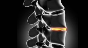 Williamson chiropractic nutrition with vitamin D and quercitrin