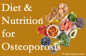 Williamson osteoporosis prevention tips from your chiropractor include improved diet and nutrition and decreased sodium, bad fats, and sugar intake. 