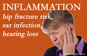 Apple Country Chiropractic recognizes inflammation’s role in pain and presents how it may be a link between otitis media ear infection and increased hip fracture risk. Interesting research!