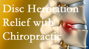 Apple Country Chiropractic gently treats the disc herniation causing back pain. 